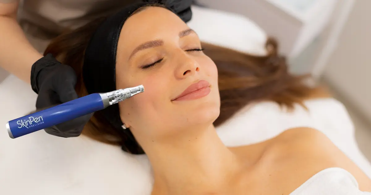  A Realistic Guide to Microneedling Downtime
