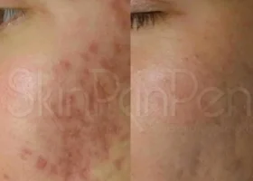 455067050_26276928895287471_4760781104628514085_n